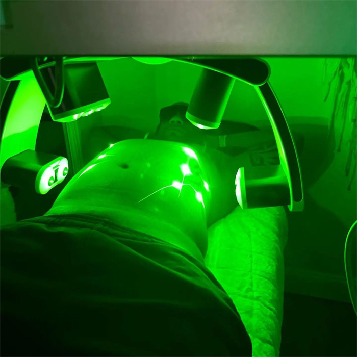 EmeraFuse 10D Advanced Body Contouring Laser 