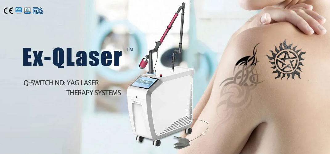 Q-Switched Nd:YAG Laser System Q-Switched Nd:YAG Laser System