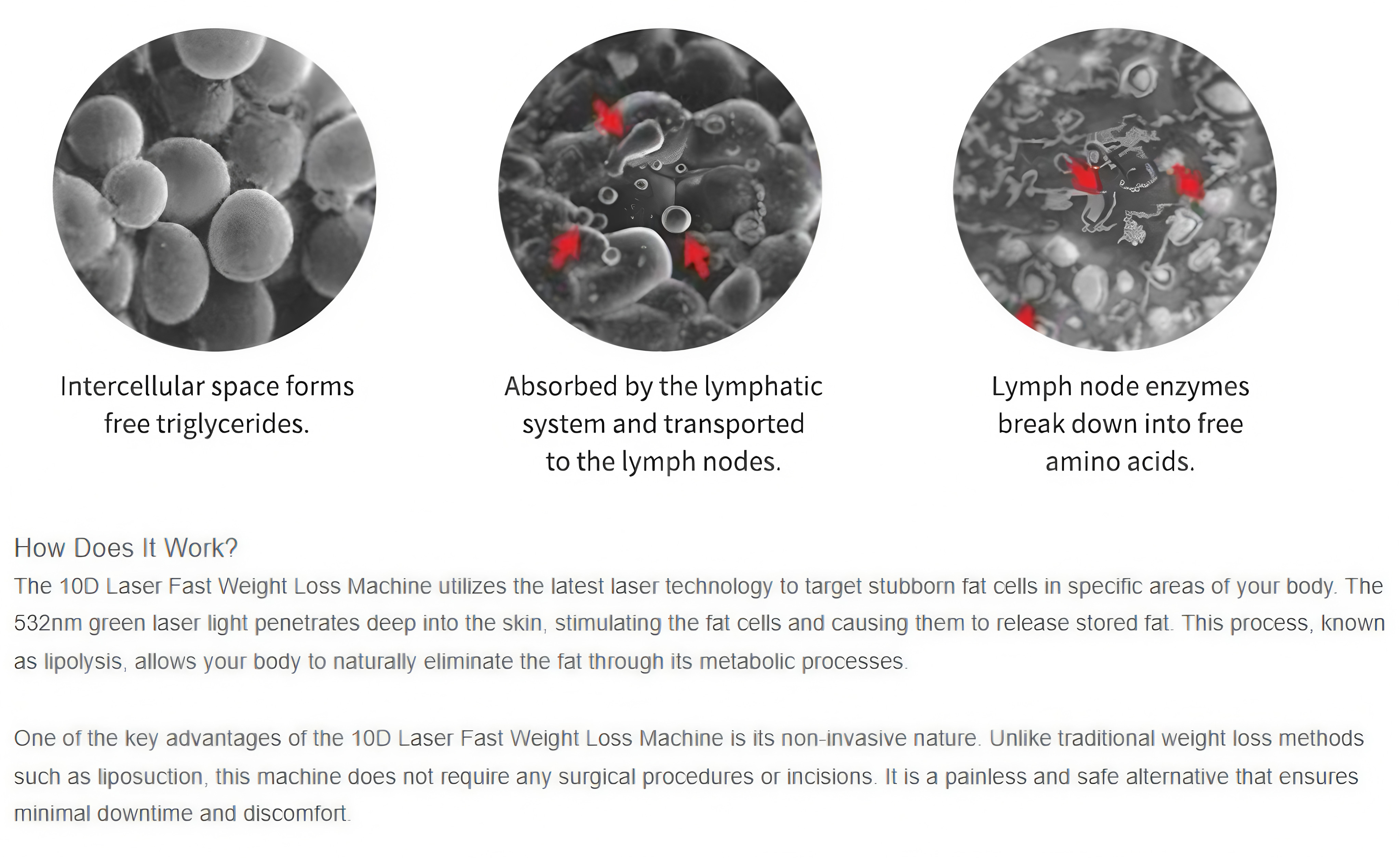 EmeraFuse 10D Advanced Body Contouring Laser 