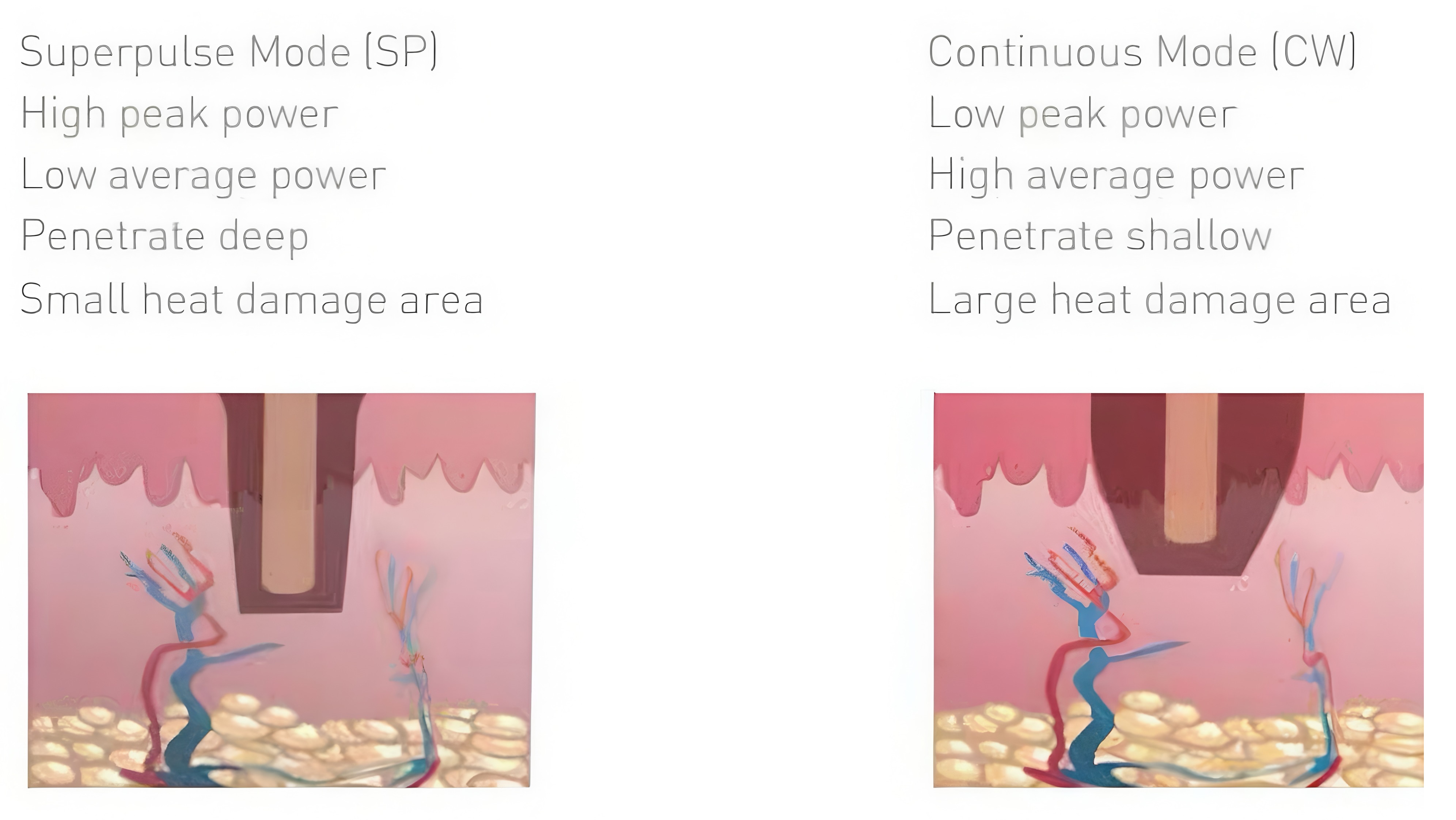 FDA-Cleared Fractional CO2 Laser Technology