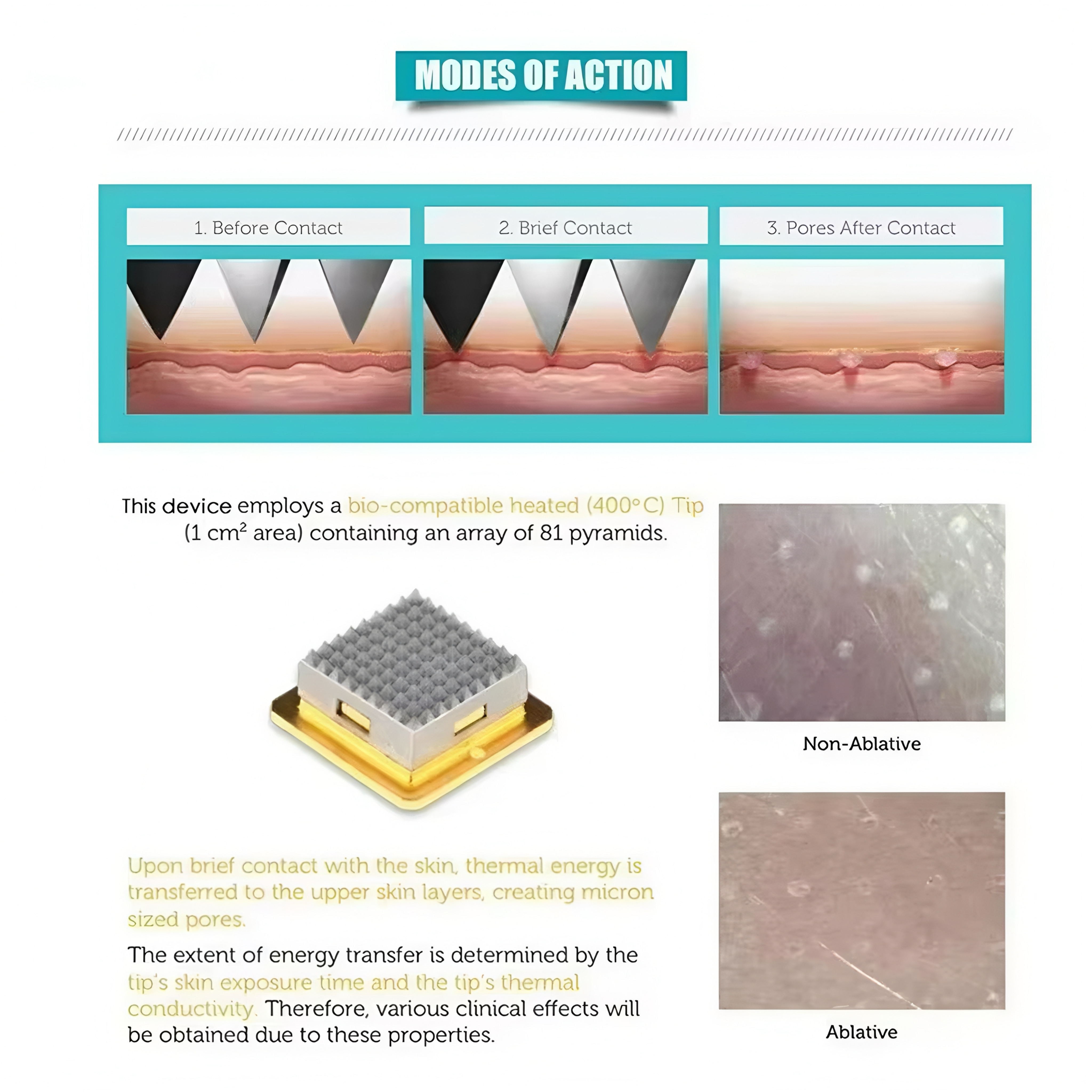 Dermatix – Revolutionary Skin Rejuvenation Technology